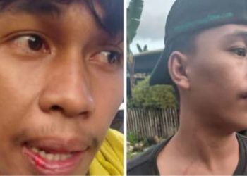 Arogansi Pemilik Alat Berat, Dua Warga Masale Maros Jadi Korban Penganiayaan